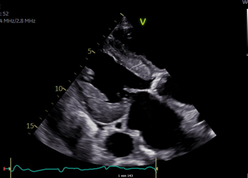 Aufbau- und Refresherkurs Echokardiographie