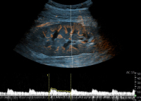 DEGUM-Aufbaukurs 2025