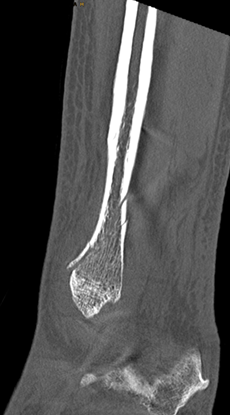 Neues Röntgengerät mit Cone-Beam-CT und 3D-Technologie