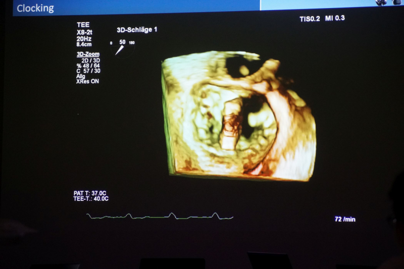 Echo-Grundkurs im Februar 2024 am Standort Juliusspital